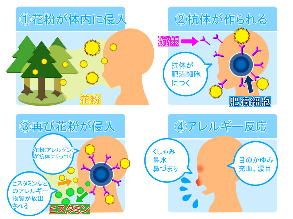 花粉症･･･その病態と対策と治療と│Dr.OTONOの独り言 :: おとのクリニック＊音野慶仁ブログ